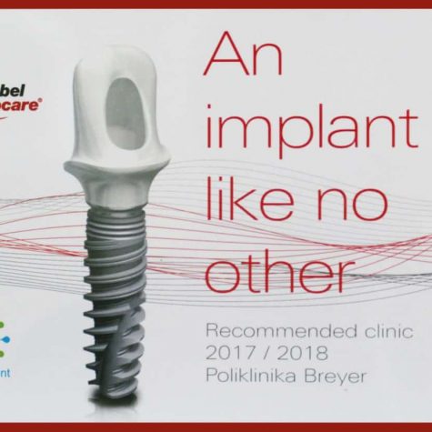 nobel-biocare-garancija-kvalitete-dentalna-stomatološka-poliklinika-breyer-implantati-all-on-4-origirnal-all-on-6
