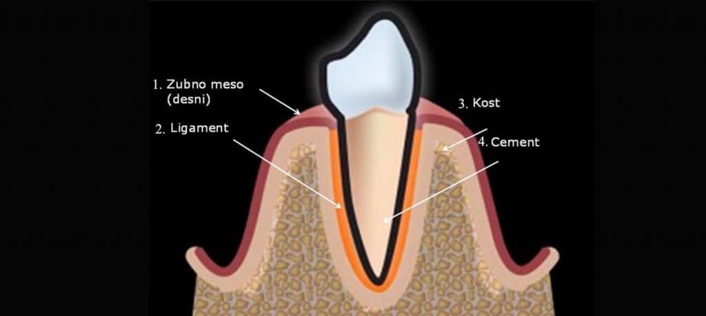 parodont-parodontoza-stomatološka-poliklinika-breyer