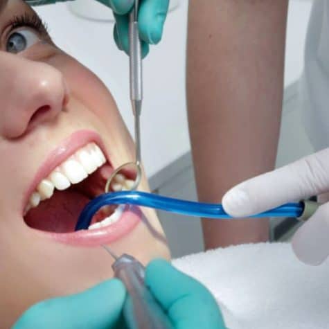 estetska-stomatologija-stomatološka-poliklinika-breyer-nobel-biocare-najbolja