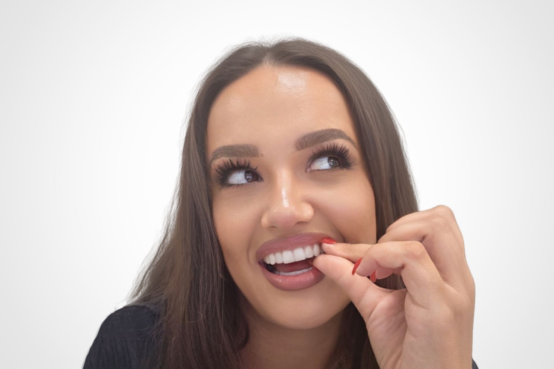 Nevidljivi aparatic za zube